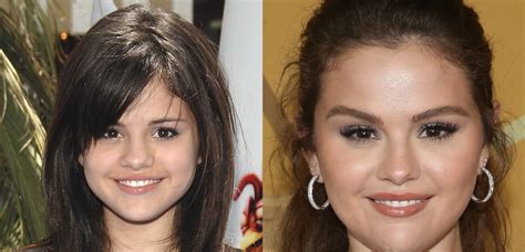 selena gomez boobs before and after|Selena Gomez All Plastic Surgery Revealed – Before。